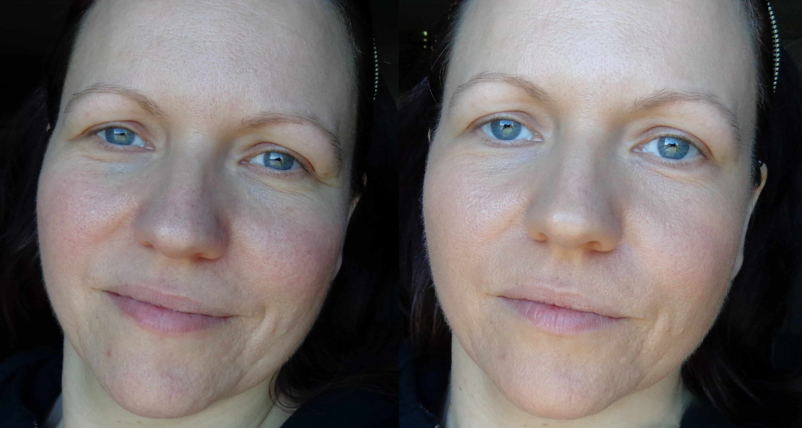 Matte bb cream before and after